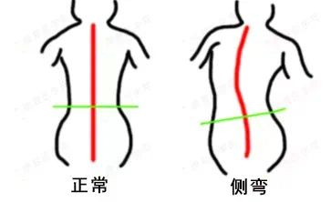 九游体育网站：【国家级培训课程】2024年国家体育总局青少年脊柱侧弯体态干预师培训通知(图2)